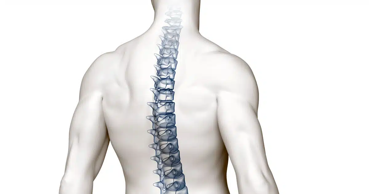 Chiropratica la sublussazione