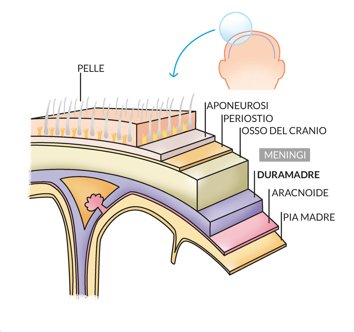 Tensione dura madre