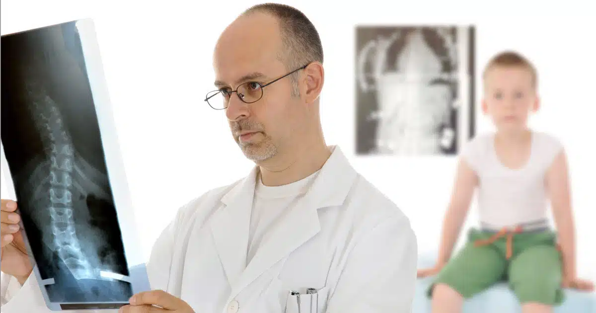 scoliosi chiropratica